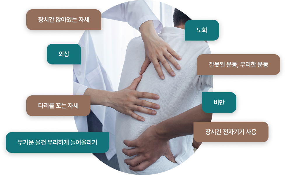 허리디스크의 원인