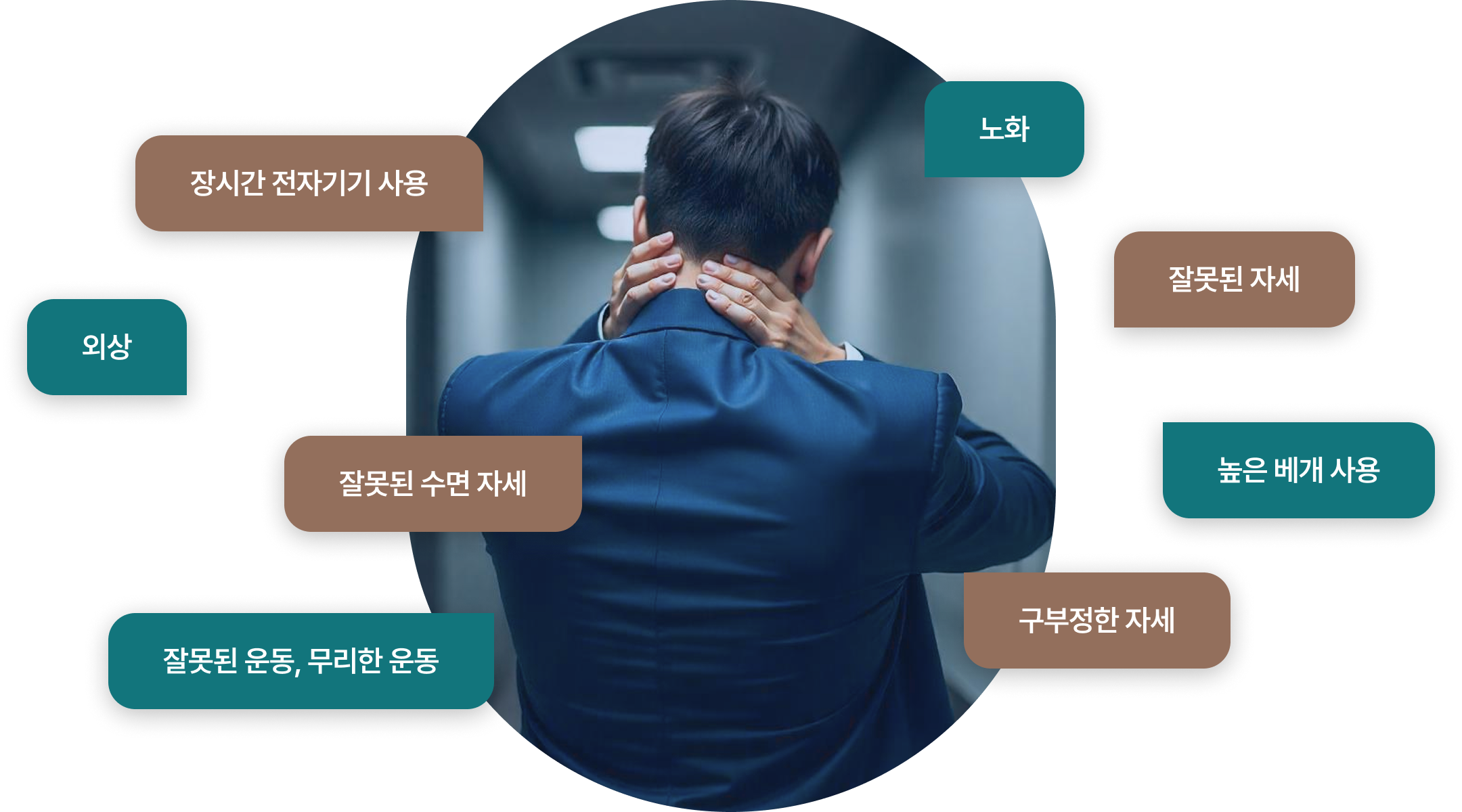 목디스크의 원인
