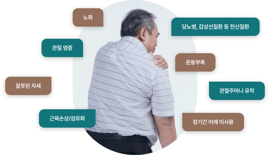 오십견의 원인