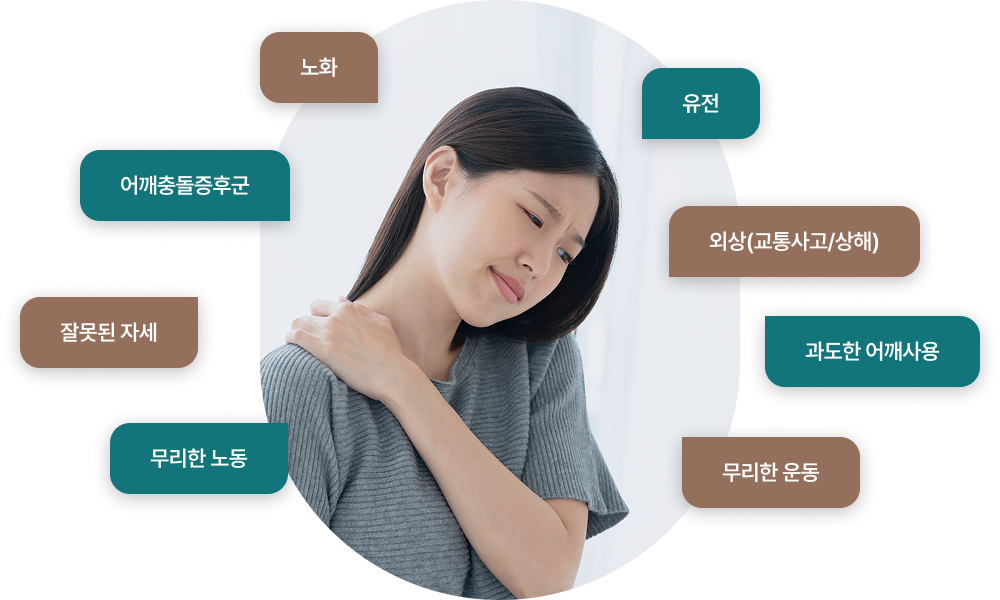 회전근장애의 원인