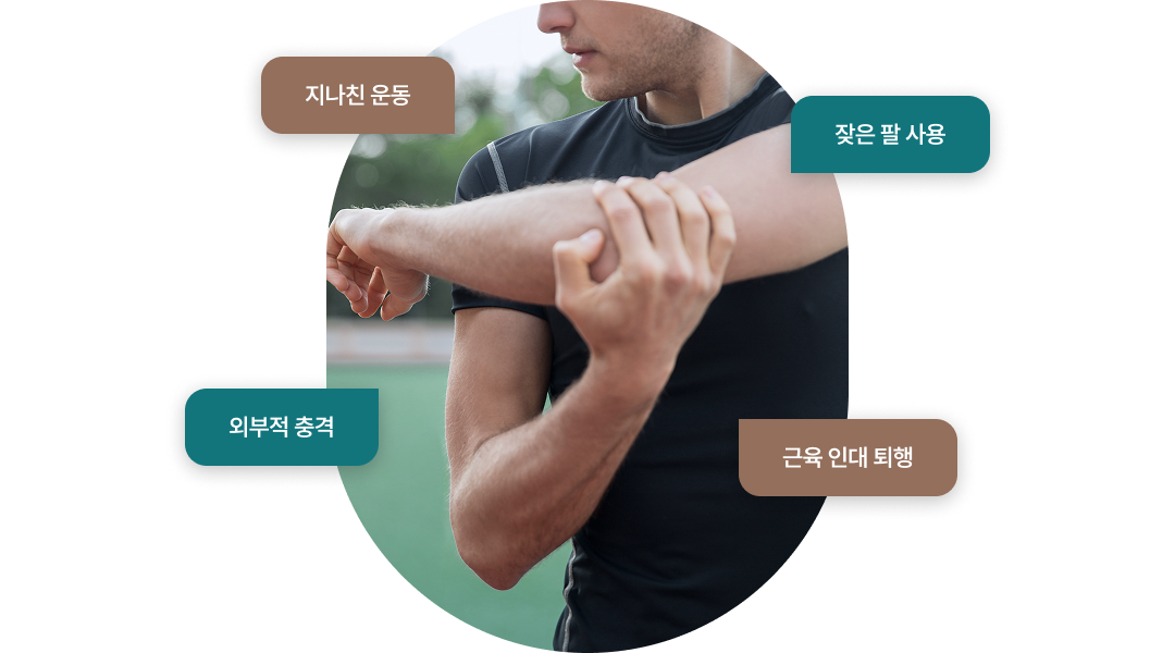 테니스엘보우의 원인