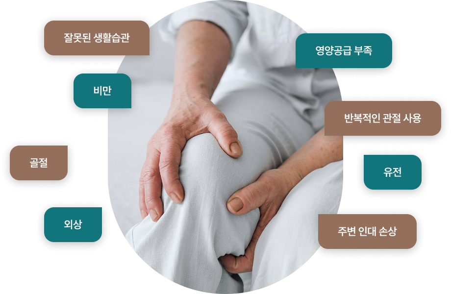 퇴행성관절염의 원인