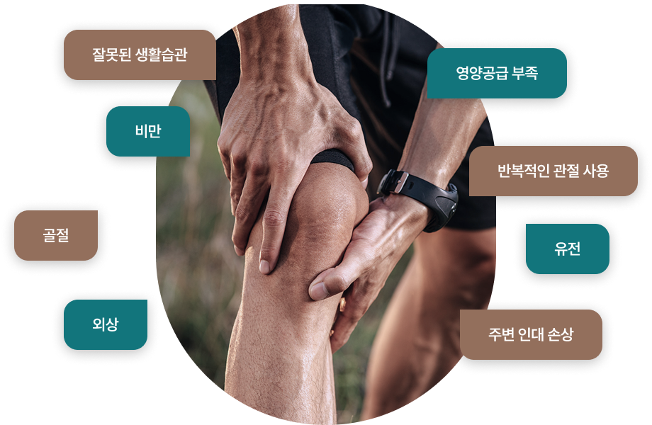 반월상연골파열의 원인