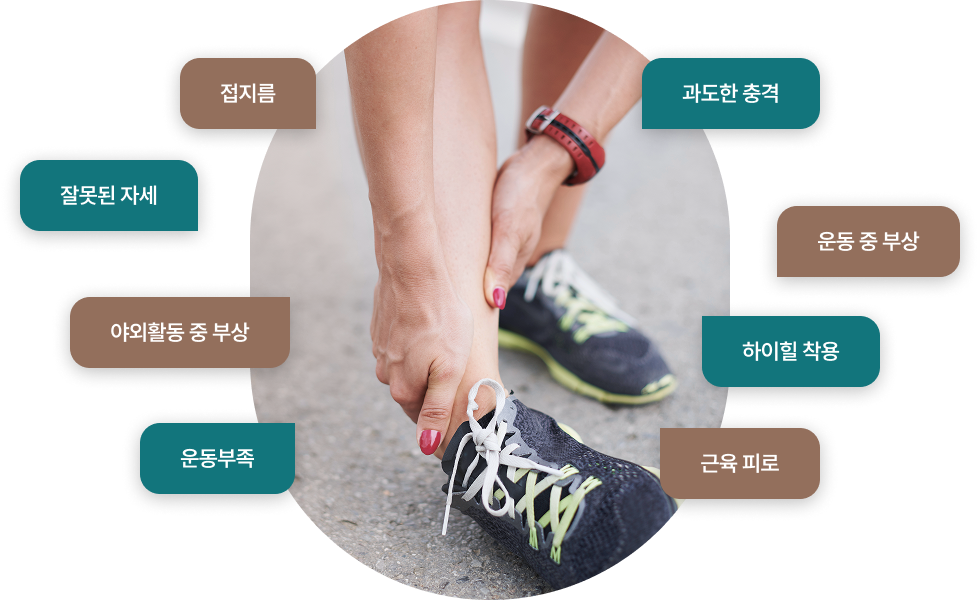 인대염좌의 원인